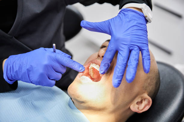 Best Emergency Wisdom Tooth Extraction in Royalton, IL